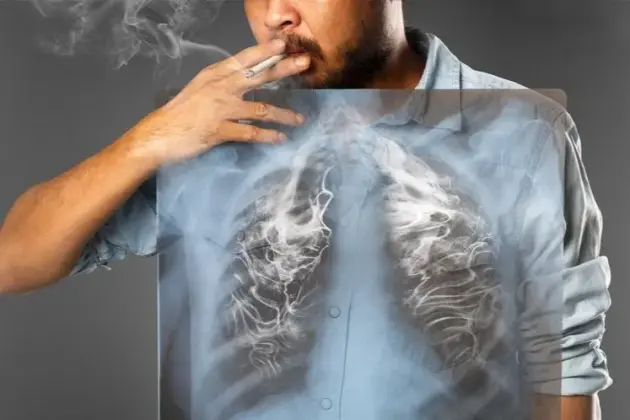 Program profilaktyki chorób odtytoniowych (w tym POChP)